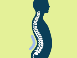 Emotionale Heilung Lordose (Krümmung Wirbelsäule/Hohlkreuz)