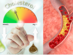 NEUTRALISIERUNG VON HOHEM CHOLESTERIN